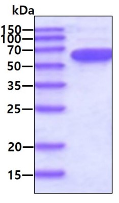 SDS-PAGE (PKM2-11H).jpg